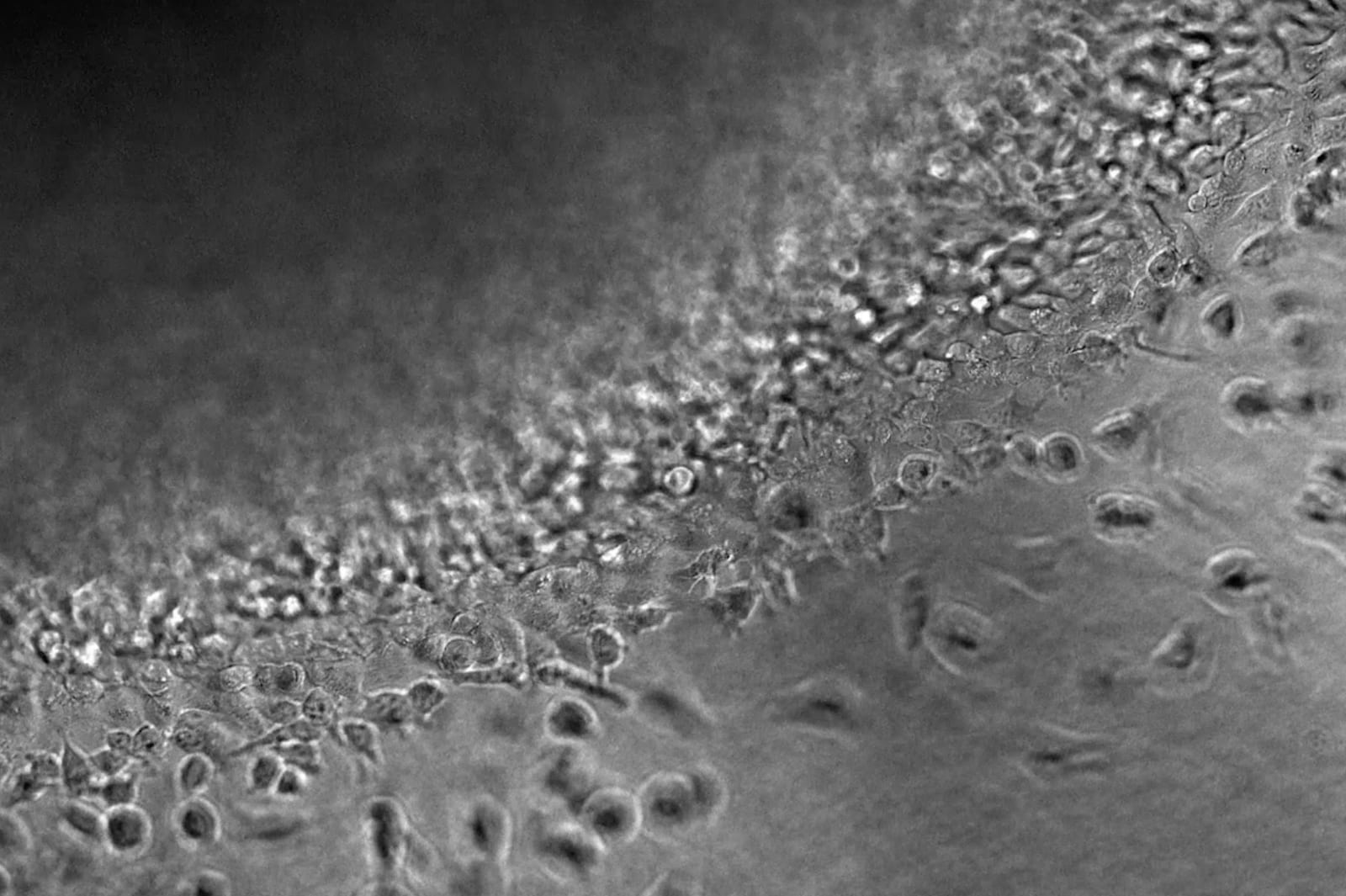 Mechanobiology: the missing dimension in preclinical research